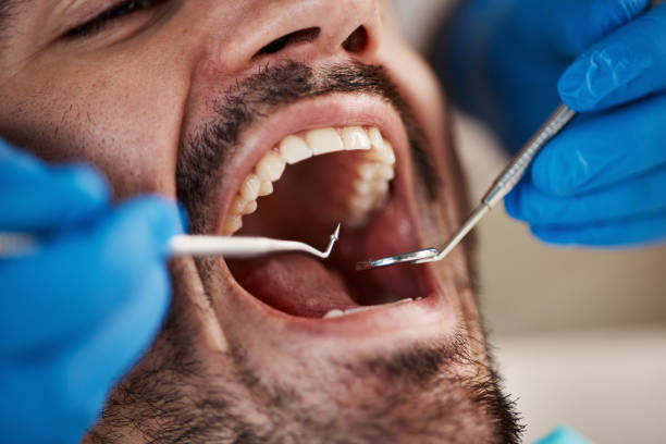 Best Emergency Wisdom Teeth Removal in Hahira, GA