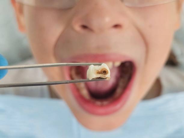 Best Same-Day Emergency Dentist in Hahira, GA